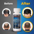 thumbnail image 2 of Minoxidil-5% Extra Strength Hair Regrowth for Men, 6 Month Supply, 2 of 5