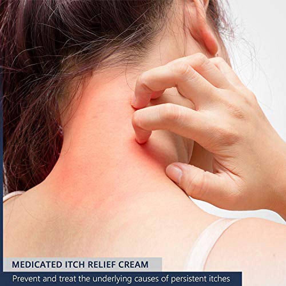 Medcosa Adult Rash Cream - Fast Relief from Sweat Rash, Heat Rash