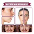 thumbnail image 4 of Suero facial ácido de frutas de 30ml, ácido salicílico, esencia para reducir los poros, piel Ygjytge Cuidado Belleza, 4 of 8