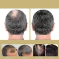 thumbnail image 5 of Red Light Therapy Cap Led Infrared Laser Hair Growth Hat Helmet Loss Treatment, 5 of 5