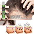 thumbnail image 3 of Spray herbal para el crecimiento del cabello, para cabello debilitado y caída posparto, suero natural 10 ml x 3, 3 of 5