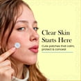 thumbnail image 4 of Popmask Happy Face Acne Patches Hydrocolloid Acne Dots with Salicylic Acid and Tea Tree Oil 72 Spot Patches for Pimples and Blemishes, 4 of 9