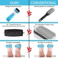 thumbnail image 5 of Electric Foot File Callus Remover - Foot Scrub Pedicure Kit, 5 of 5