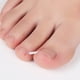 thumbnail image 4 of Ygjytge Almohadillas De Relleno Para Uñas Encarnadas Alivio Del Dolor Corrector De Uñas Almohadillas De Ranura (50 Piezas) Ygjytge Para estrenar, 4 of 9