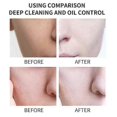 thumbnail image 4 of Kojic Acid Facial Cleanser 150ml - Gentle Foaming Face Wash for Glowing, Smooth, Refreshed Skin - Daily Cleansing Formula - Non-Drying, Suitable for A, 4 of 5