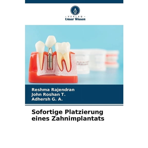 Sofortige Platzierung eines Zahnimplantats, (Paperback)