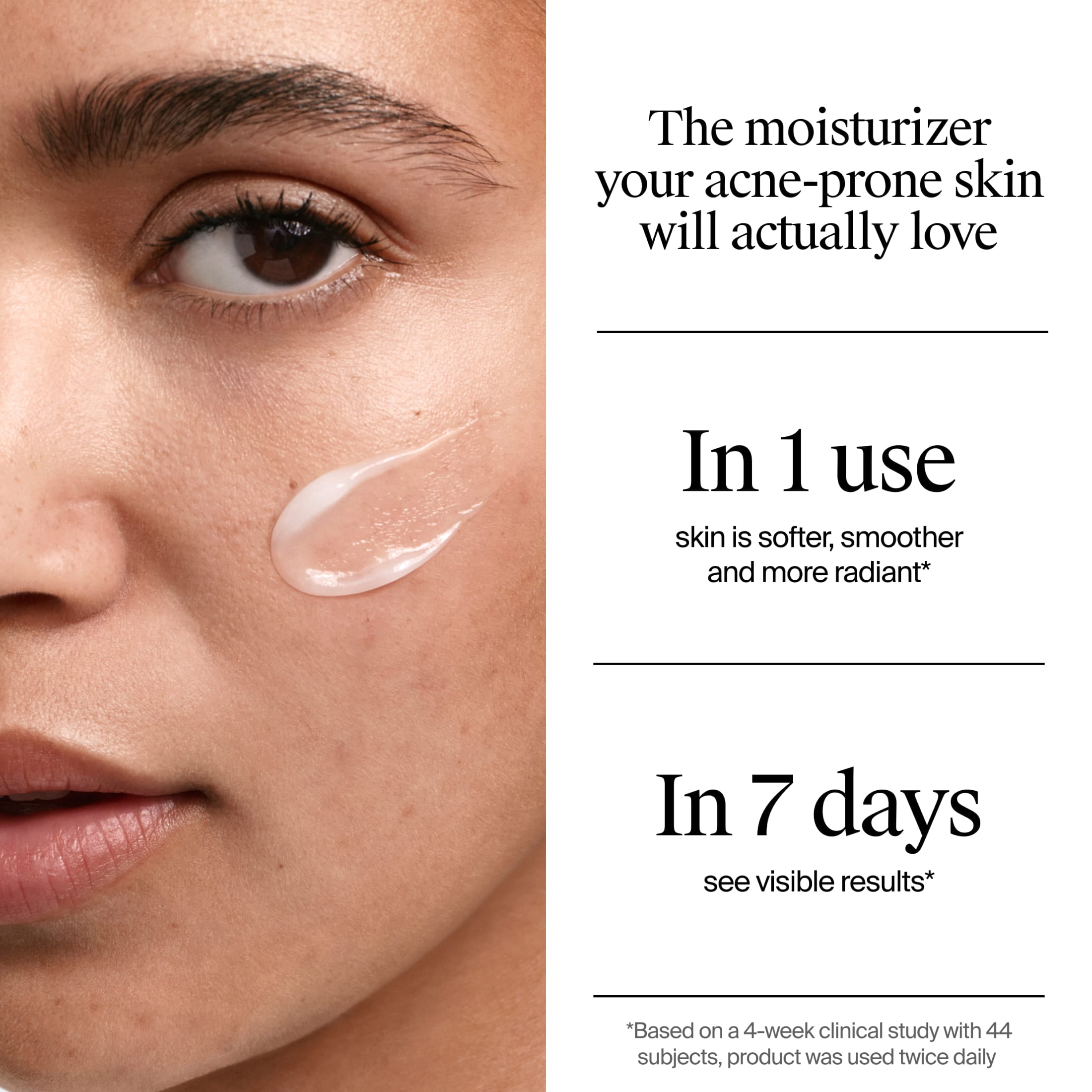 Neutrogena Evenly Clear Acne Gel Moisturizer, 1.7 fl. oz