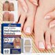thumbnail image 2 of 60pcs Toenail Fungus Treatment Stickers Ingrowning Toenail Nail Repair Patch, 2 of 5