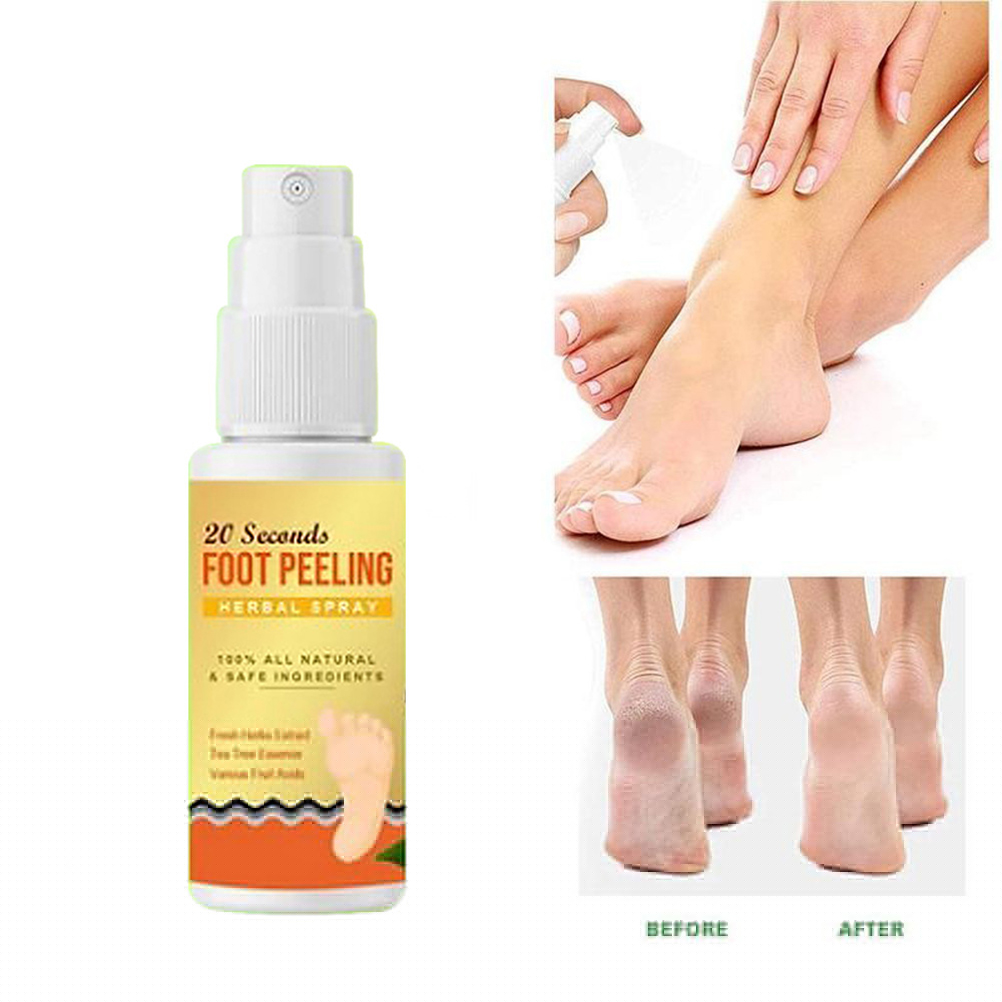thumbnail image 5 of Spray antipicazón para pies a base de hierbas Beriberi de 30ml para eliminar el olor y el sudor de los pies, 5 of 6