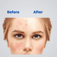 thumbnail image 5 of Gelmicin Hydrocortisone 1% Fast Acting Anti-Itch Cream For Skin Rashers, Allergies, Eczema 1.41oz, 5 of 5