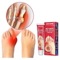 thumbnail image 1 of Ungüento para aliviar el dolor de gota y juanete de 20g, crema Correctora de Valgus para articulaciones de los dedos del pie, tratamiento de artritis Lumbar para la rodilla, yeso médico. Afortunado Sencillez, 1 of 5