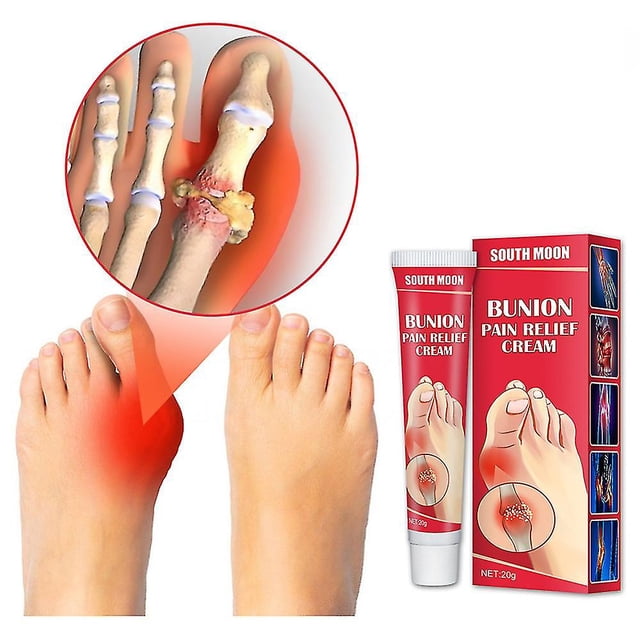 Ungüento para aliviar el dolor de gota y juanete de 20g, crema Correctora de Valgus para articulaciones de los dedos del pie, tratamiento de artritis Lumbar para la rodilla, yeso médico. Afortunado Sencillez