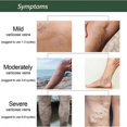 thumbnail image 2 of Jabón para masajes intravenosos, Fonen, alivia el sangrado de las piernas hinchadas, limpieza de piernas con lombrices de tierra Maikang - Caja de 100 g | 4054757263009, 2 of 2