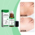 thumbnail image 4 of Fiudx Bola de Aceite de Ricino, Aceite Esencial Nutritivo, Hidratante para El Cuidado de La Piel, Calmante y Reparador para Piel Seca, Masaje Facial, Corporal y Capilar, para Todo Tipo de Piel, para, 4 of 6