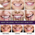 thumbnail image 3 of For 3pcs V34 Toothpaste Mousse Teeth Cleaning Whitening Toothpaste Teeth Removing Tooth Stains Oral, 3 of 5