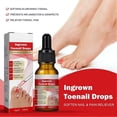 thumbnail image 2 of Ingrown Toenail Repair Essence Gel Nail Surface Improving Liquid For Men Women Nail Treatment, 2 of 5