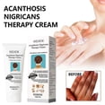 thumbnail image 3 of 3pcs Acanthosis Cream Nigrifix Cream For Acanthosis Nigricans Black Spot, 3 of 5