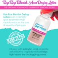 thumbnail image 4 of Loción secante para el acné Bye Bye Bye Blemish Reduce las espinillas, 30 ml, paquete de 1, 4 of 7
