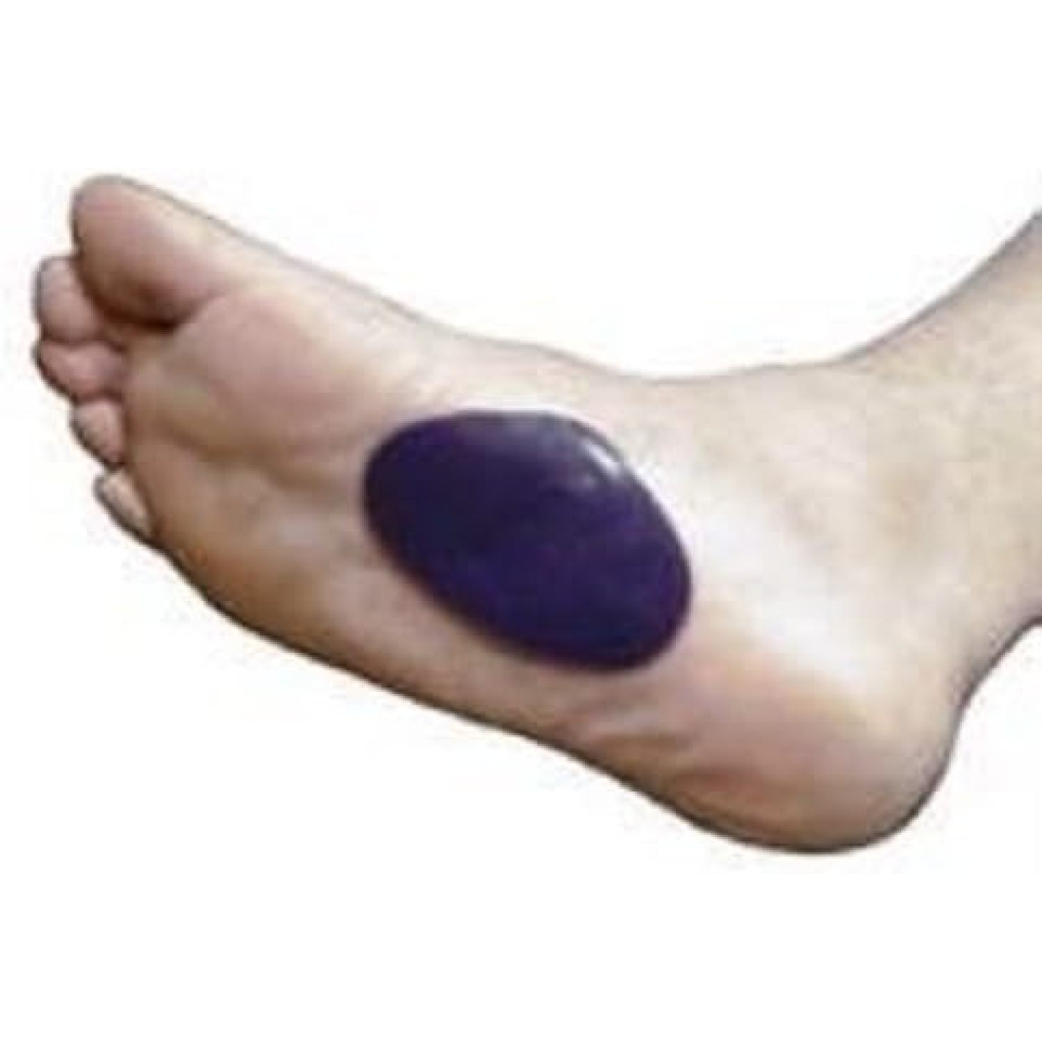 Dr. Jill's Foot Pads Gel Arch Pads Thick