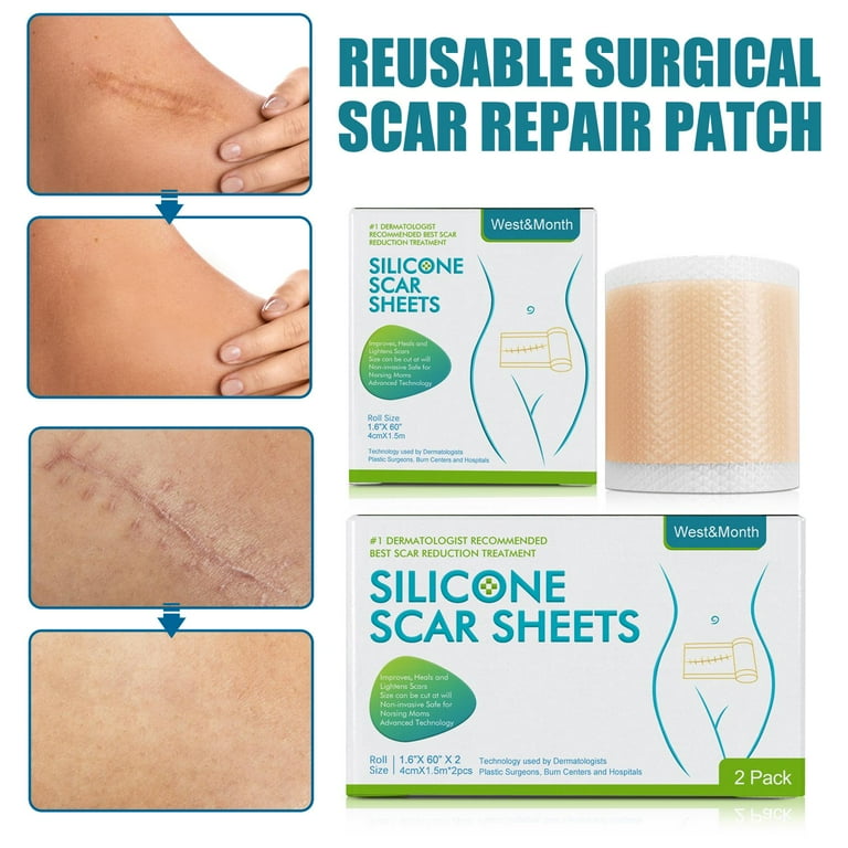 Surgery Scar Removal Sticker Sheet Patch Silicone Gel B0W1 Scars J2L2 A3B8 T2B7 Treatment D5E5