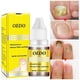 thumbnail image 1 of Aceite Esencial para el Cuidado de Hongos en las Uñas, Solución Antibacteriana para el Cuidado de los Pies y Manicura, 10ml, 1 of 5