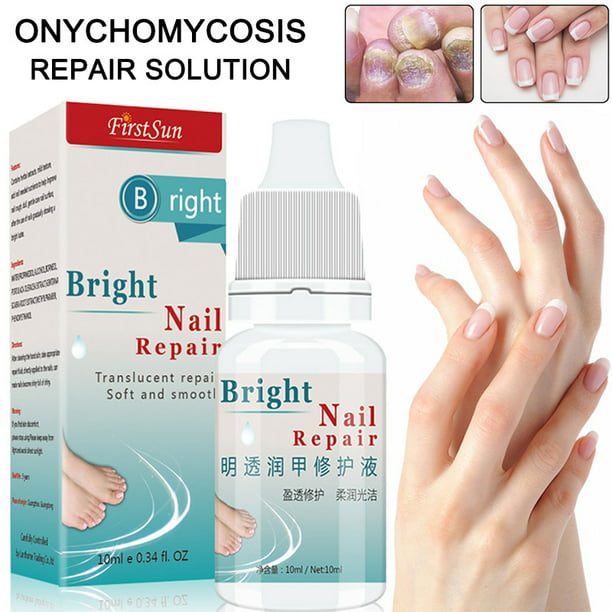 Nail Repair Liquid Treatment Pen Nail Care Onychomycosis Paronychia Anti Nail Infection | Wish