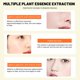 thumbnail image 5 of 15ml Remove Melasma Pen Remove Dark Spots Melanin Melasma Remover Face Skin Care Ndcxsfigh Cuidado Belleza, 5 of 9