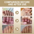 thumbnail image 5 of Fiudx Tratamiento Herbal para Uñas, Solución Nutritiva Natural para Uñas Más Fuertes y Sanas, Reparación Rápida de Uñas Gruesas y Descoloridas, Exfoliación Hidratante para Uñas Quebradizas, Uso Diari, 5 of 5