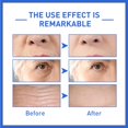 thumbnail image 5 of Botox en Bouteille Instantané Raffermissant Visage, Solution de Botox Sérum Facial, Flocons de Botox Lux, Solution de Botox Simplicité, Sérum Visage Jeune, 5 of 5