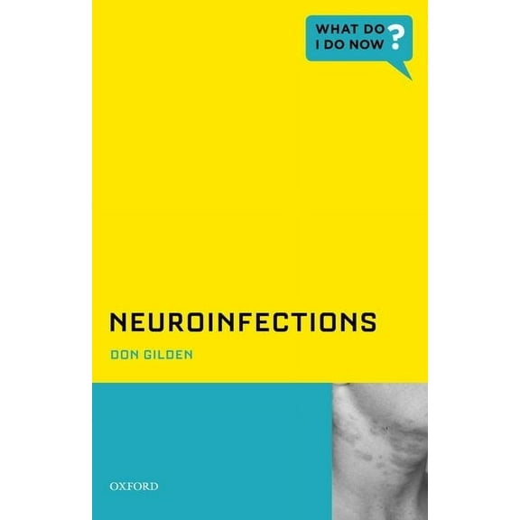 What Do I Do Now Neuroinfections, (Paperback)
