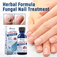 thumbnail image 4 of Tratamiento herbal para hongos en las uñas: repara las uñas grises, amarillas y engrosadas y promueve un crecimiento saludable., 4 of 4