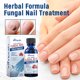 thumbnail image 4 of Tratamiento herbal para hongos en las uñas: repara las uñas grises, amarillas y engrosadas y promueve un crecimiento saludable., 4 of 4