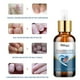 thumbnail image 4 of Gel crema para uñas onicomicosis Gel para eliminar hongos en las uñas productos para reparación de uñas de los pies, 4 of 9