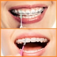 thumbnail image 4 of Cepillos interdentales Zopeal, 250 piezas, limpiadores dentales para brackets, 4 of 7