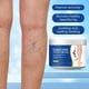 thumbnail image 2 of Crema para varices Renhe Ingenuity para piernas (2 unidades), 2 of 8
