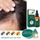thumbnail image 3 of Aceite esencial para el cuidado del cabello, reparador del folículo piloso, líquido para el crecimiento del cabello, suavizante, seco, encrespado, aceite esencial nutritivo | 8109571191024,1 pieza, 3 of 5