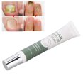 thumbnail image 4 of Crema Reparadora De Uñas, Crema Para El Tratamiento De Las Uñas De Los Pies, 20 G, Fácil De Aplicar Para Uso Diario YLSHRF Nail Repair Cream, 4 of 8