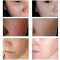 thumbnail image 4 of Suero Reafirmante de Poros ANGGREK 60ml Suero Facial Control de Aceite, 4 of 7