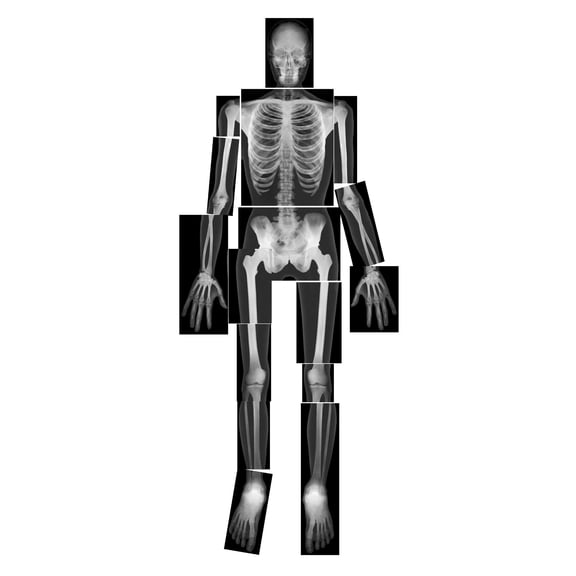 Roylco True to Life Human X-Rays Set – 18 Life-Size Skeleton X-Rays with Teaching Guide for Anatomy, Biology Learning, Light Table Display & STEM Education