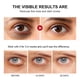 thumbnail image 5 of Crema para Ojos con Retinol onlyliua, 5 of 7