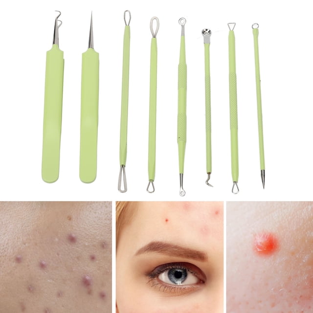 Pimples Extractor , Pimple Remover Needle Set Pointed Tip Stainless Steel Fine Ring for Salon Use