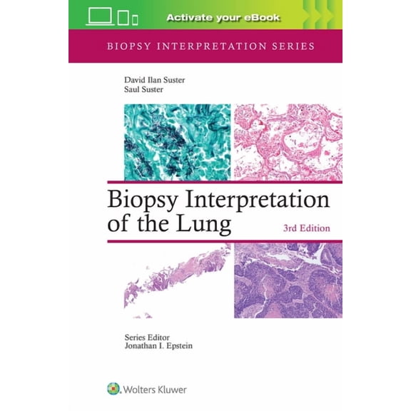 Biopsy Interpretation Biopsy Interpretation of the Lung: Print   eBook with Multimedia, (Hardcover)