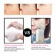 thumbnail image 5 of depurador de piel ultrasónico, 4 En 1 Ultrasónico Facial Skin Scrubber, Dispositivo De Limpieza De La Piel Facial, Masajeador De Elevación Y Limpio Para Eliminación De La Espinilla Y Limpiador De Poro Khall 1.4122E+12, 5 of 6