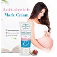 thumbnail image 3 of 2x Removes Stretch Mark Cream Pregnant Women Repair Anti-aging Anti-winkles Cream Increase Skin Elasticity Smooth Firm Skin Care, 3 of 5