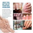 thumbnail image 5 of Nail Care Nail Repair Spray Repair And Clean Nails, Hands, Feet, Soft Nails, Thicken Nails, Polish Nails100ml, 5 of 5