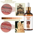 thumbnail image 5 of Suero blanqueador rápido para nudillos oscuros, Corrector de melanina para nudillos de manos, producto eliminador de manchas intensas para el cuidado de la piel negra, 50ml, 5 of 5
