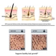 thumbnail image 6 of Aichun Hair Growth Essence 100% Plant Extract Hair Loss Scalp Treatments Ginger Genseng Raise Dense Hair Stop Liquid For Damaged Hair Enhance Your Overall Hair Condition 20ml, 6 of 9