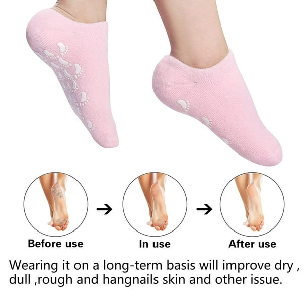 2 Pair Moisturizing Gel Socks, Ultra-Soft Gel Socks Moisturizing Socks, Spa  Gel Soften Socks for Dry Cracked Feet Skins, Gel Lining Infused with  Essential Oils and Vitamins (Blue&Pink) 