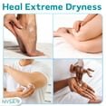 thumbnail image 4 of Urea Cream 40% + Salicylic Acid (8.5 oz), Foot Cream to Help Dry, Cracked Feet & Heels by Nysa-9, 4 of 7