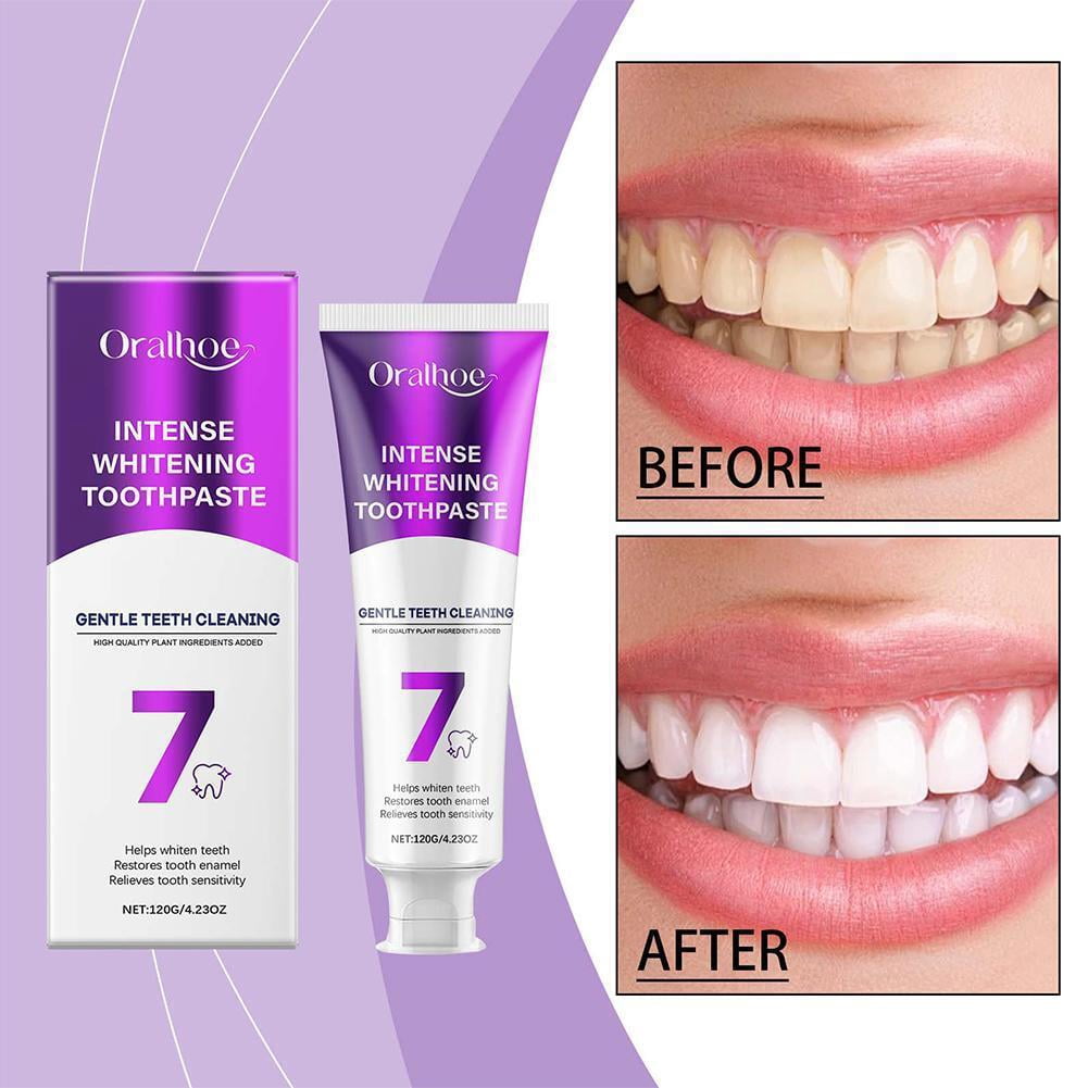 Pasta Dental Blanqueadora Intensa Eliminaci n De Manchas En Los Dientes pasta-dental-blanqueadora-intensa-eliminaci-n-de-manchas-en-los-dientes